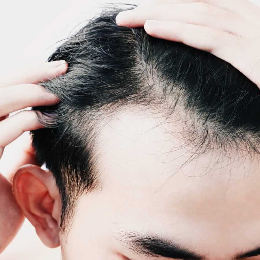 Men's thinning hair fixes