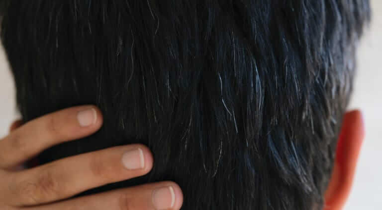 The End of Going Gray?