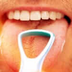 Not Using a Tongue Scraper Is a Mistake
