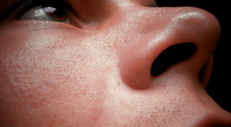 How to Care for Your Skin Barrier