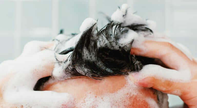 Fight Flakes – Dandruff Treatment Options