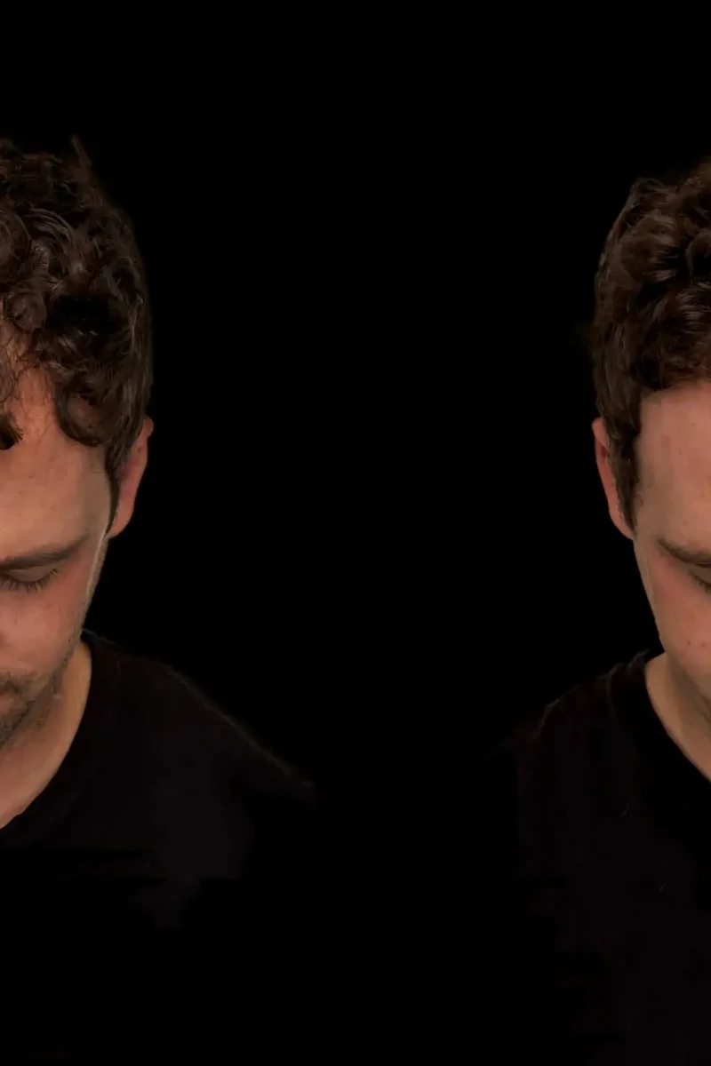 Best hair loss treatments for men